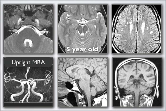 High-Resolution Neuroimaging